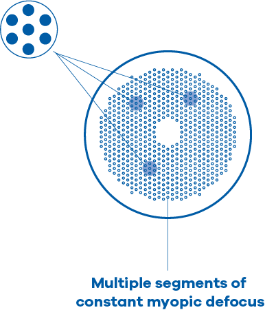 A MiYOSMART lens seen face on: hundreds of small defocus segments spread evenly across the lens surface around a clear central zone, with one group magnified. Captioned: multiple segments of constant myopic defocus